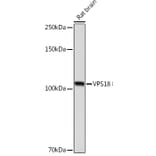 Western Blot - Anti-VPS18 Antibody [ARC2156] (A307022) - Antibodies.com