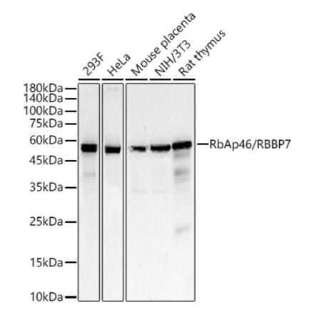Western Blot - Anti-RBBP7 Antibody [ARC55384] (A307025) - Antibodies.com
