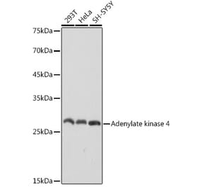Western Blot - Anti-AK3L1 Antibody [ARC2572] (A307026) - Antibodies.com