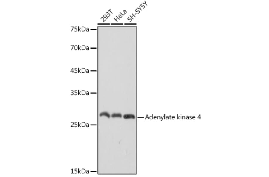 Western Blot - Anti-AK3L1 Antibody [ARC2572] (A307026) - Antibodies.com