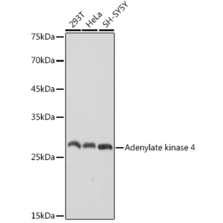 Western Blot - Anti-AK3L1 Antibody [ARC2572] (A307026) - Antibodies.com