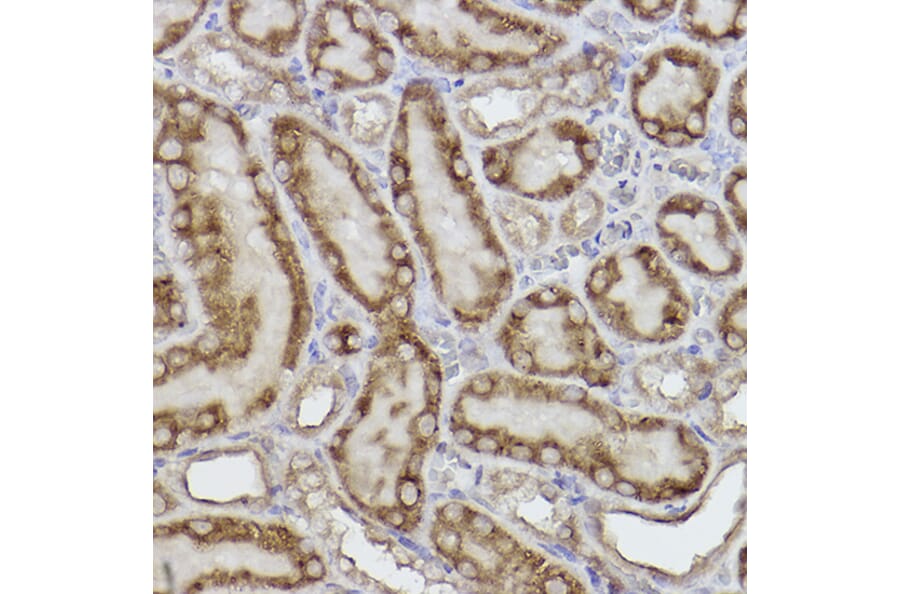 Immunohistochemistry - Anti-AK3L1 Antibody [ARC2572] (A307026) - Antibodies.com