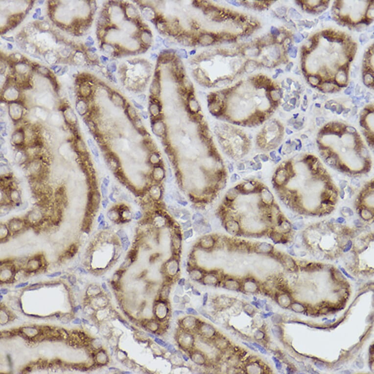 Immunohistochemistry - Anti-AK3L1 Antibody [ARC2572] (A307026) - Antibodies.com