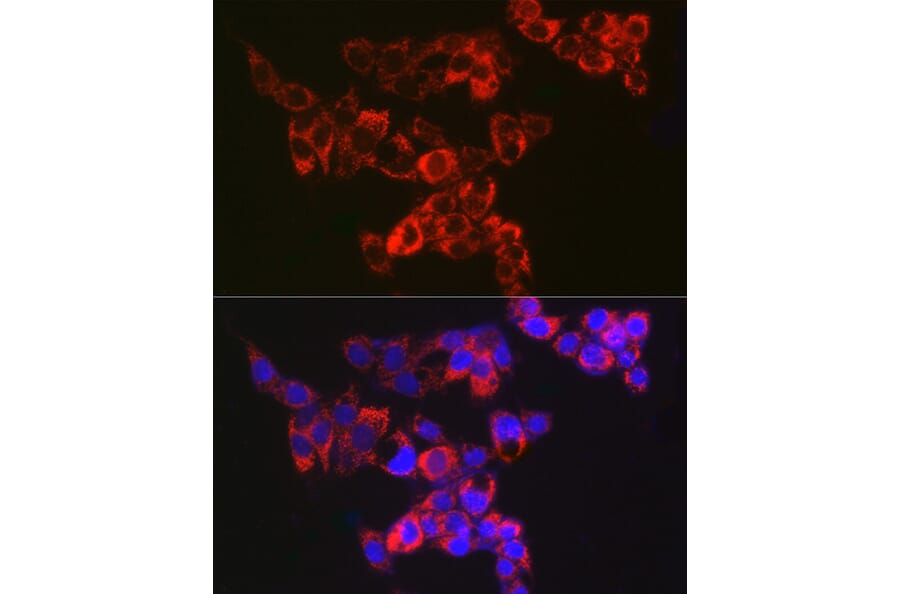 Immunofluorescence - Anti-AK3L1 Antibody [ARC2572] (A307026) - Antibodies.com