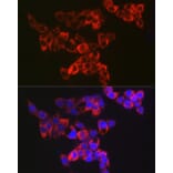 Immunofluorescence - Anti-AK3L1 Antibody [ARC2572] (A307026) - Antibodies.com