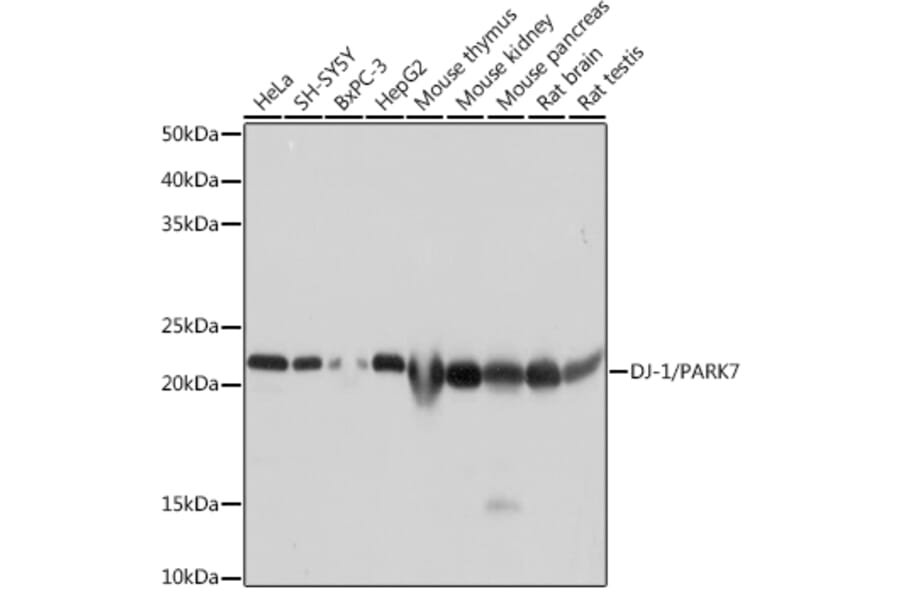 Western Blot - Anti-PARK7/DJ1 Antibody [ARC0354] (A307029) - Antibodies.com