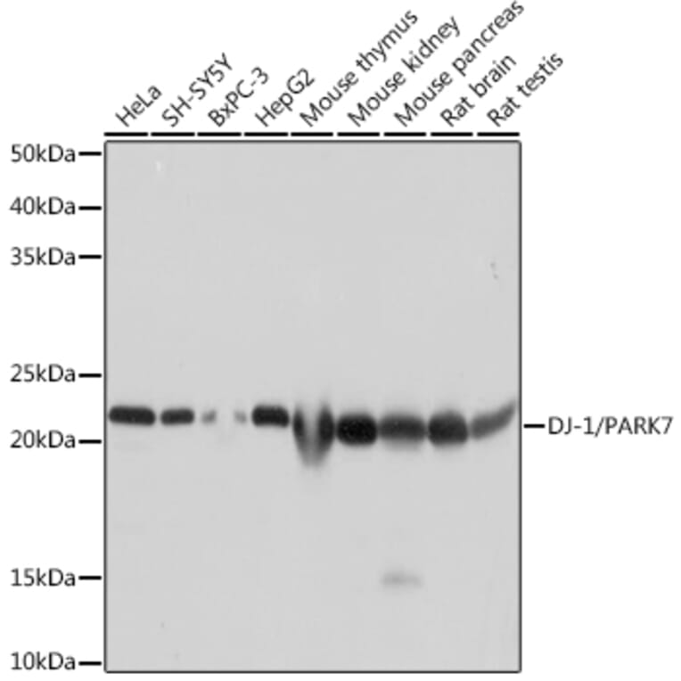 Western Blot - Anti-PARK7/DJ1 Antibody [ARC0354] (A307029) - Antibodies.com