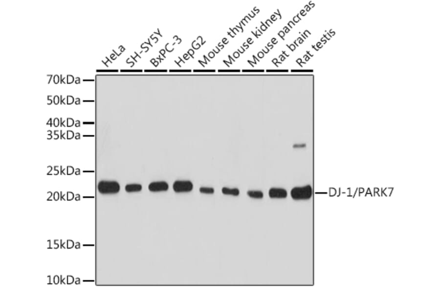 Western Blot - Anti-PARK7/DJ1 Antibody (A307030) - Antibodies.com