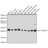 Western Blot - Anti-PARK7/DJ1 Antibody (A307030) - Antibodies.com