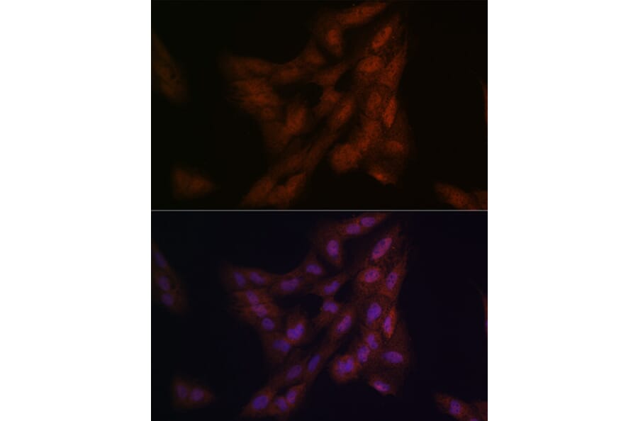 Immunofluorescence - Anti-PARK7/DJ1 Antibody (A307030) - Antibodies.com