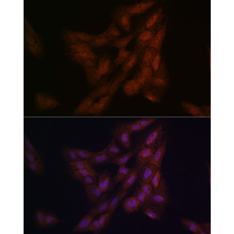 Immunofluorescence - Anti-PARK7/DJ1 Antibody (A307030) - Antibodies.com