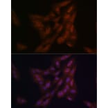 Immunofluorescence - Anti-PARK7/DJ1 Antibody (A307030) - Antibodies.com