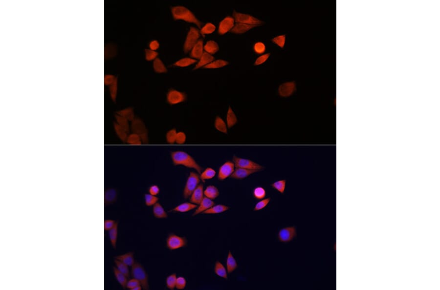 Immunofluorescence - Anti-PARK7/DJ1 Antibody (A307030) - Antibodies.com