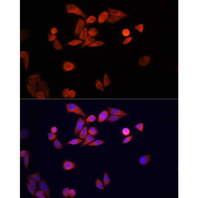 Immunofluorescence - Anti-PARK7/DJ1 Antibody (A307030) - Antibodies.com