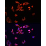 Immunofluorescence - Anti-PARK7/DJ1 Antibody (A307030) - Antibodies.com