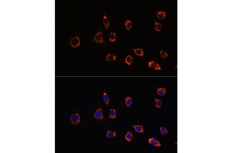 Immunofluorescence - Anti-PARK7/DJ1 Antibody (A307030) - Antibodies.com