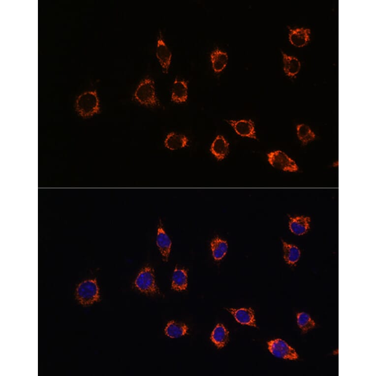 Immunofluorescence - Anti-PARK7/DJ1 Antibody (A307030) - Antibodies.com