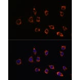Immunofluorescence - Anti-PARK7/DJ1 Antibody (A307030) - Antibodies.com