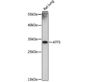 Western Blot - Anti-ATF5 Antibody (A307031) - Antibodies.com