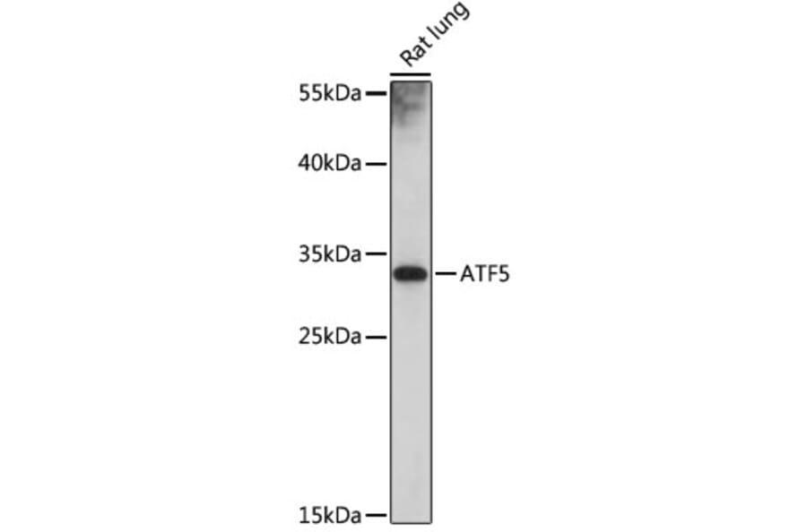 Western Blot - Anti-ATF5 Antibody (A307031) - Antibodies.com