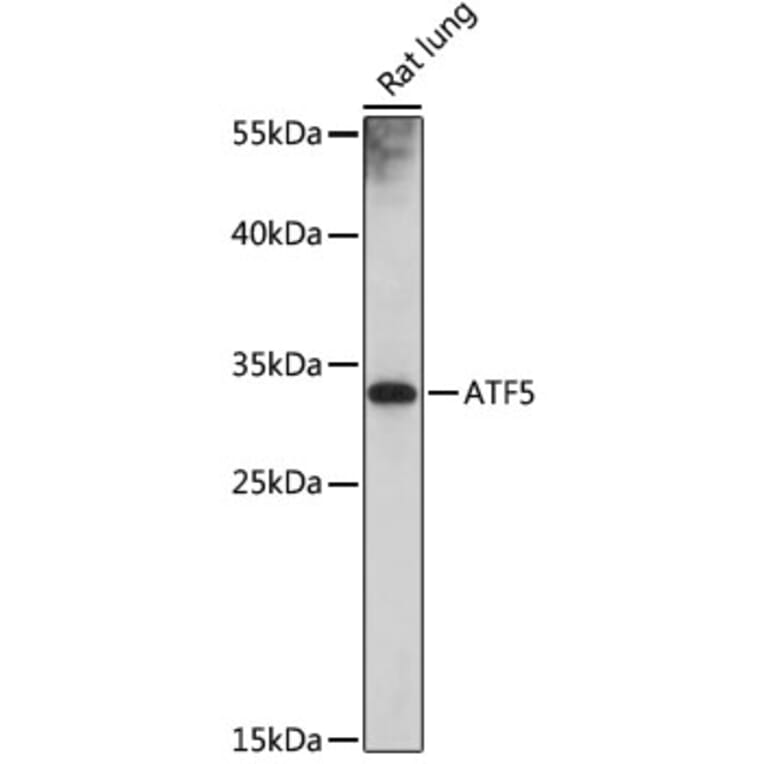 Western Blot - Anti-ATF5 Antibody (A307031) - Antibodies.com