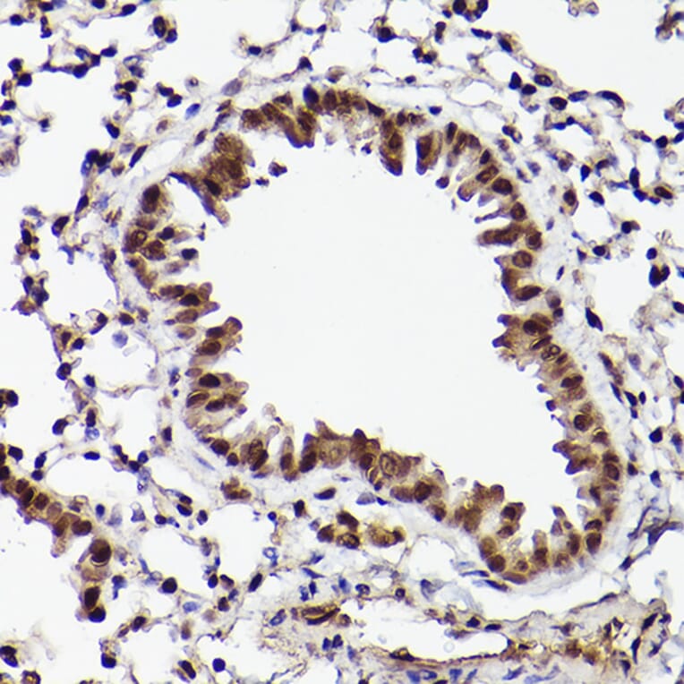 Immunohistochemistry - Anti-ATF5 Antibody (A307031) - Antibodies.com