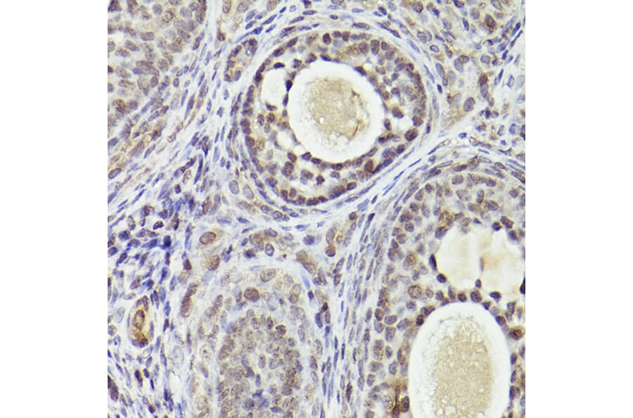 Immunohistochemistry - Anti-ATF5 Antibody (A307031) - Antibodies.com