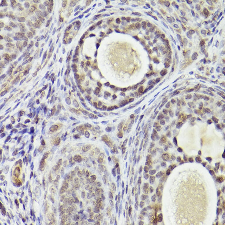 Immunohistochemistry - Anti-ATF5 Antibody (A307031) - Antibodies.com