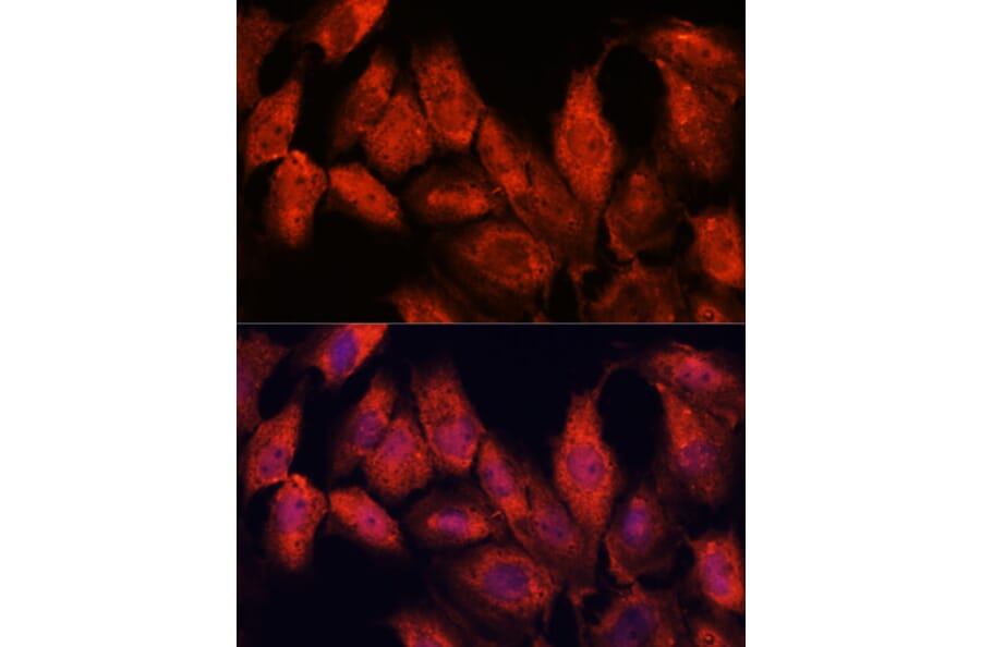 Immunofluorescence - Anti-ATF5 Antibody (A307031) - Antibodies.com