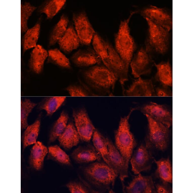 Immunofluorescence - Anti-ATF5 Antibody (A307031) - Antibodies.com