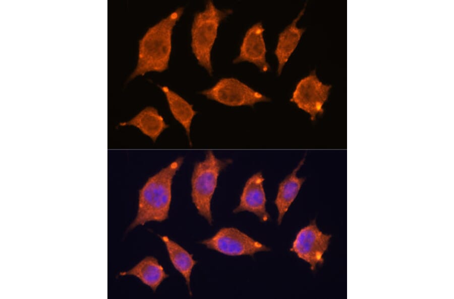 Immunofluorescence - Anti-ATF5 Antibody (A307031) - Antibodies.com
