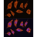 Immunofluorescence - Anti-ATF5 Antibody (A307031) - Antibodies.com