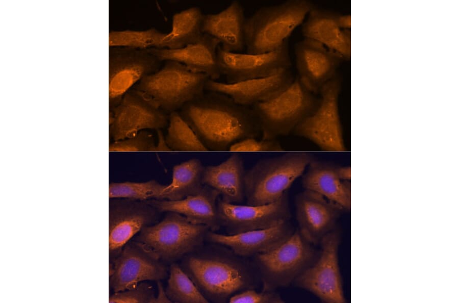 Immunofluorescence - Anti-ATF5 Antibody (A307031) - Antibodies.com