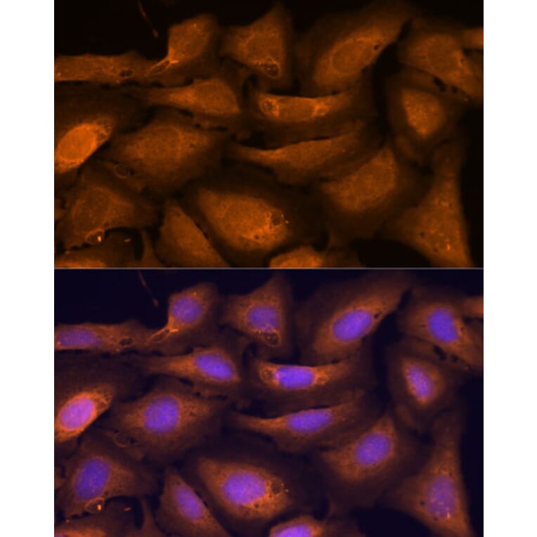 Immunofluorescence - Anti-ATF5 Antibody (A307031) - Antibodies.com