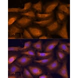 Immunofluorescence - Anti-ATF5 Antibody (A307031) - Antibodies.com