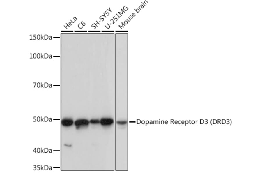 Western Blot - Anti-Dopamine Receptor D3/DRD3 Antibody [ARC1041] (A307032) - Antibodies.com