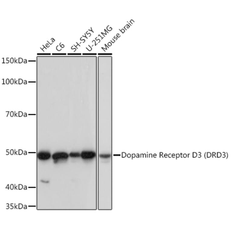 Western Blot - Anti-Dopamine Receptor D3/DRD3 Antibody [ARC1041] (A307032) - Antibodies.com