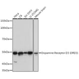 Western Blot - Anti-Dopamine Receptor D3/DRD3 Antibody [ARC1041] (A307032) - Antibodies.com