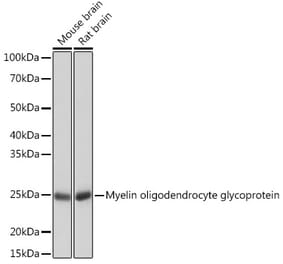 Western Blot - Anti-Myelin oligodendrocyte glycoprotein Antibody [ARC0879] (A307033) - Antibodies.com