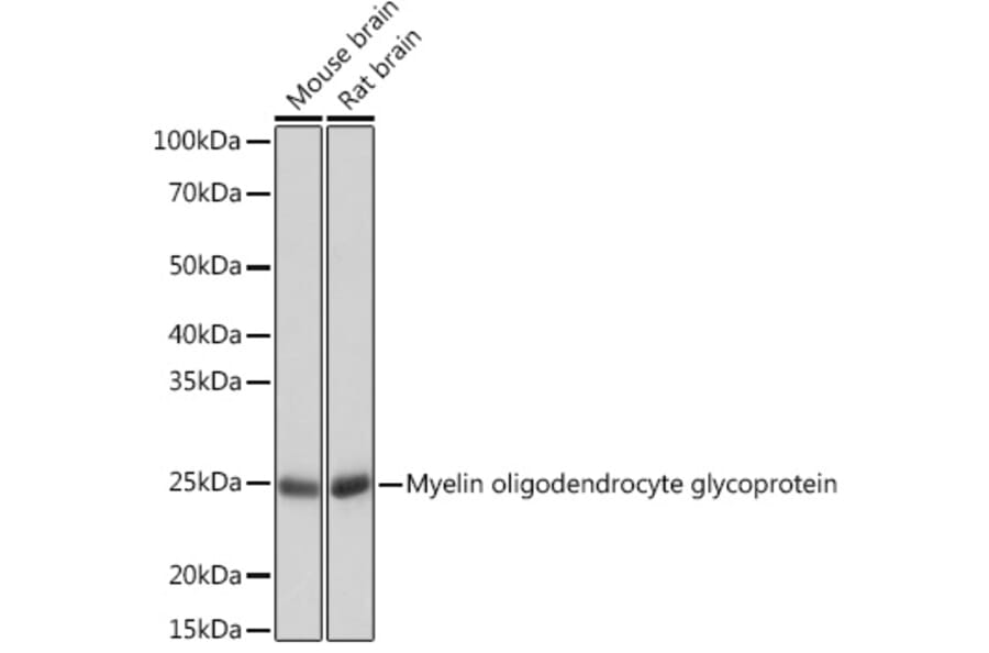 Western Blot - Anti-Myelin oligodendrocyte glycoprotein Antibody [ARC0879] (A307033) - Antibodies.com