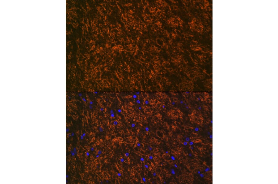 Immunofluorescence - Anti-Myelin oligodendrocyte glycoprotein Antibody [ARC0879] (A307033) - Antibodies.com