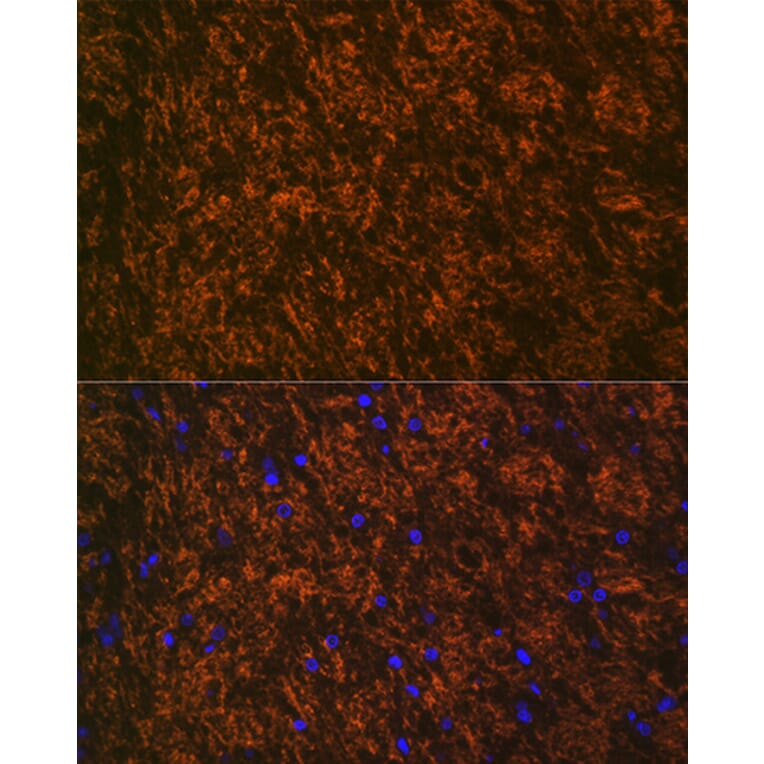 Immunofluorescence - Anti-Myelin oligodendrocyte glycoprotein Antibody [ARC0879] (A307033) - Antibodies.com