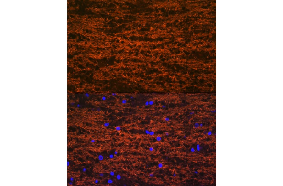 Immunofluorescence - Anti-Myelin oligodendrocyte glycoprotein Antibody [ARC0879] (A307033) - Antibodies.com