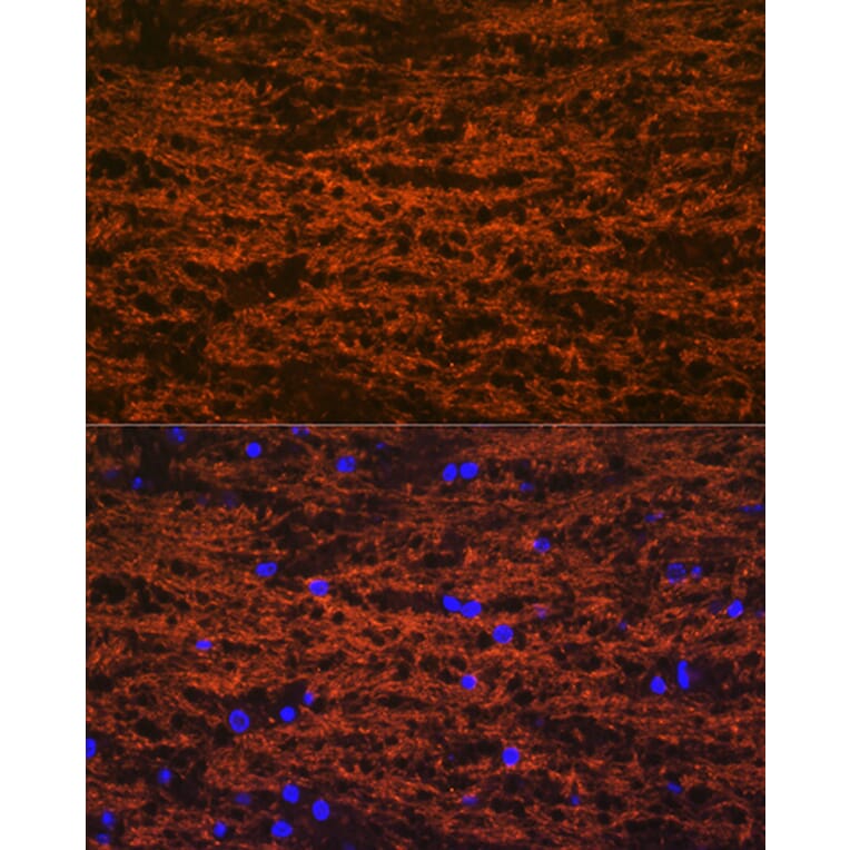 Immunofluorescence - Anti-Myelin oligodendrocyte glycoprotein Antibody [ARC0879] (A307033) - Antibodies.com