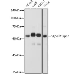 Western Blot - Anti-SQSTM1 / p62 Antibody (A307034) - Antibodies.com