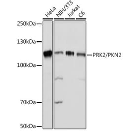 Western Blot - Anti-PKN2 Antibody [ARC2274] (A307039) - Antibodies.com