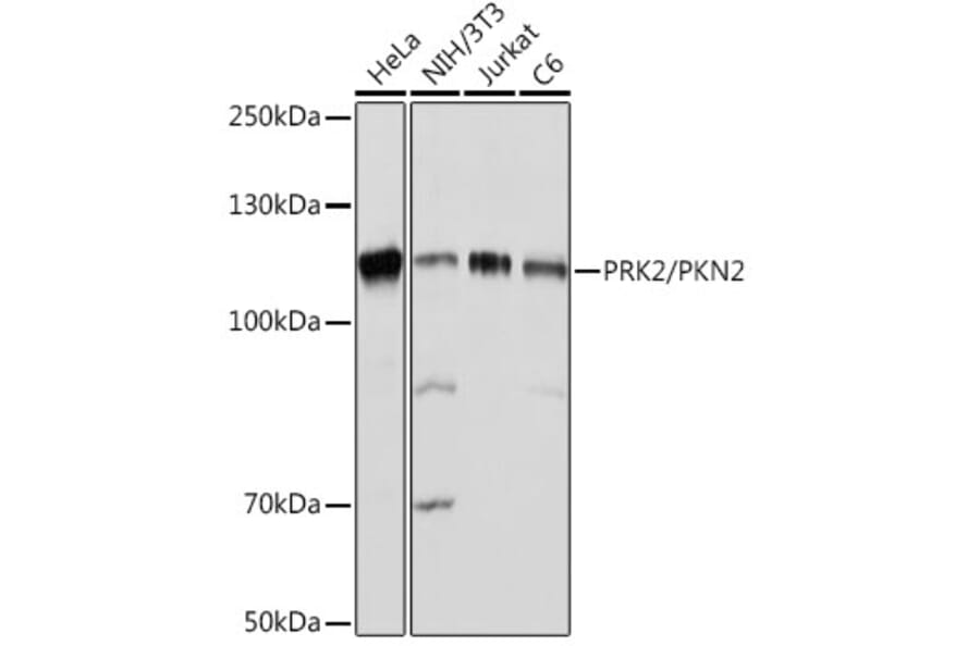 Western Blot - Anti-PKN2 Antibody [ARC2274] (A307039) - Antibodies.com