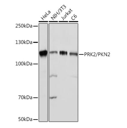 Western Blot - Anti-PKN2 Antibody [ARC2274] (A307039) - Antibodies.com