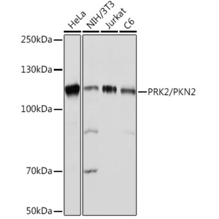 Western Blot - Anti-PKN2 Antibody [ARC2274] (A307039) - Antibodies.com