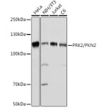 Western Blot - Anti-PKN2 Antibody [ARC2274] (A307039) - Antibodies.com